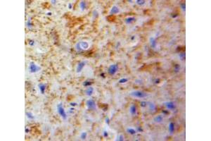Used in DAB staining on fromalin fixed paraffin-embedded Brain tissue (Neuroglobin Antikörper  (AA 1-151))