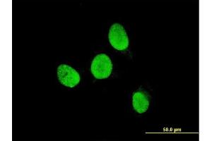 Immunofluorescence of monoclonal antibody to TESK2 on HeLa cell. (TESK2 Antikörper  (AA 405-542))