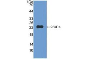 Detection of Recombinant MMP12, Mouse using Polyclonal Antibody to Matrix Metalloproteinase 12 (MMP12) (MMP12 Antikörper  (AA 294-473))