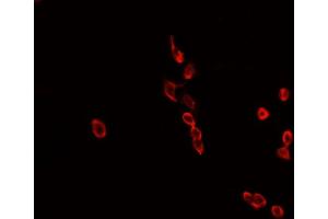 ABIN6268808 staining MCF-7 cells by IF/ICC. (HNRNPL Antikörper  (N-Term))