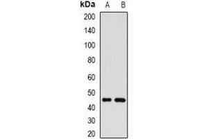 Western blot analysis of GP73 expression in SKOV3 (A), SHSY5Y (B) whole cell lysates. (GOLM1 Antikörper)