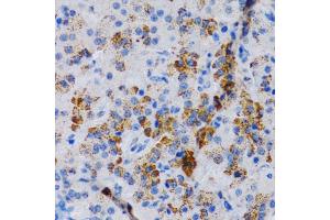 Immunohistochemistry (IHC) image for anti-Cytochrome P450, Family 24, Subfamily A, Polypeptide 1 (CYP24A1) (AA 36-448) antibody (ABIN1679472)
