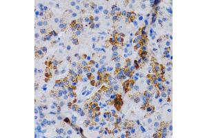 Immunohistochemistry of paraffin-embedded rat pancreas using CYP24 antibody (805) at dilution of 1:200 (40x lens). (CYP24A1 Antikörper  (AA 36-448))