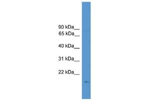 WB Suggested Anti-CSN3 Antibody Titration: 0. (CSN3 Antikörper  (N-Term))