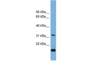 WB Suggested Anti-CTDSP2 Antibody Titration: 0. (CTDSP2 Antikörper  (Middle Region))