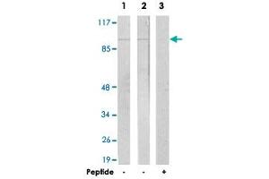 Western blot analysis of extracts from LoVo cells (Lane 1) and A-549 cells (Lane 2 and lane 3), using JAKMIP2 polyclonal antibody . (JAKMIP2 Antikörper  (C-Term))