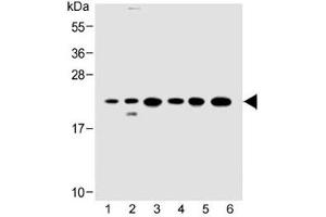 Western Blotting (WB) image for anti-GTPase Kras (KRAS) (AA 146-174) antibody (ABIN3031120)