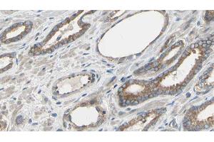 ABIN6277549 at 1/100 staining Human prostate tissue by IHC-P.