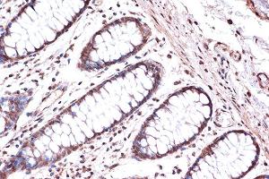 Immunohistochemistry of paraffin-embedded human colon using KIF4A Rabbit mAb (ABIN7268134) at dilution of 1:100 (40x lens).