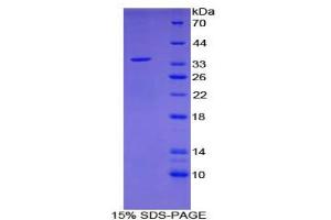 SDS-PAGE analysis of Human EGR3 Protein. (EGR3 Protein)