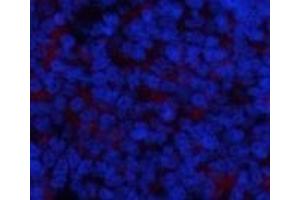 Immunofluorescence analysis of Rat spleen tissue using Phospho-IkB alpha (Ser32/S36) Polyclonal Antibody at dilution of 1:200 (NFKBIA Antikörper  (pSer32, pSer36))