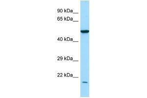 WB Suggested Anti-RAB7L1 Antibody Titration: 1.