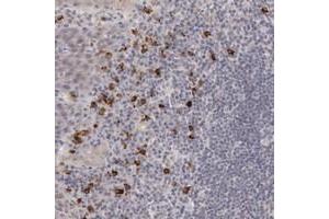 Immunohistochemical staining of human tonsil with RGAG1 polyclonal antibody  shows strong cytoplasmic positivity in a subset of lymphoid cells outside reaction centra). (RGAG1 Antikörper)