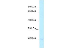 WB Suggested Anti-Tsen15 Antibody Titration: 1. (TSEN15 Antikörper  (C-Term))