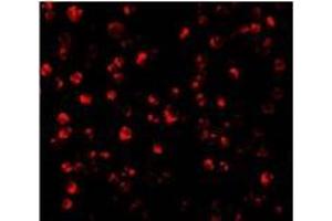 Immunofluorescence of ATF6 in MCF7 cells with this product atF6 antibody at 10 µg/ml. (ATF6 Antikörper  (C-Term))