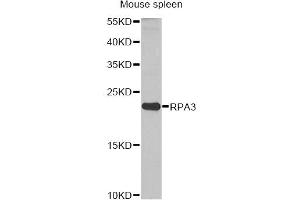 Western blot analysis of extracts of mouse spleen, using RPA3 antibody. (RPA3 Antikörper)