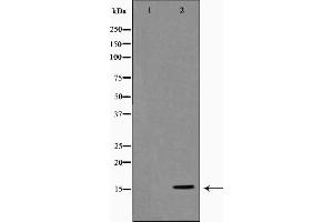 Western blot analysis on COLO205 cell lysate using Histone H3 Antibody，The lane on the left is treated with the antigen-specific peptide. (Histone 3 Antikörper)