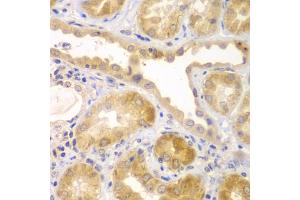 Immunohistochemistry of paraffin-embedded human kidney using UBA6 antibody (ABIN5975585) at dilution of 1/100 (40x lens). (UBA6 Antikörper)