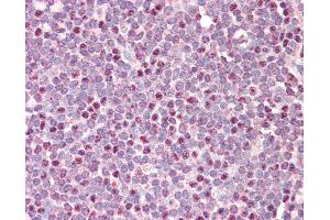 Anti-CDCA5 / Sororin antibody IHC staining of human tonsil. (CDCA5 Antikörper  (AA 110-159))