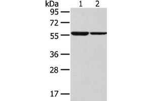 Gel: 8 % SDS-PAGE, Lysate: 40 μg, Lane 1-2: K562 and hepg2 cell, Primary antibody: ABIN7192521(SLC7A11 Antibody) at dilution 1/300 dilution, Secondary antibody: Goat anti rabbit IgG at 1/8000 dilution, Exposure time: 30 seconds (SLC7A11 Antikörper)