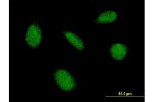Immunofluorescence of purified MaxPab antibody to CAMK4 on HeLa cell.