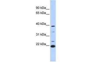 Image no. 1 for anti-Penta-EF-Hand Domain Containing 1 (PEF1) (AA 180-229) antibody (ABIN6744280)