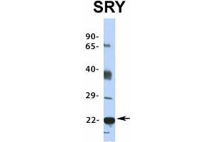 Host:  Rabbit  Target Name:  SRY  Sample Type:  HepG2  Antibody Dilution:  1.