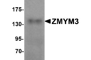 Western Blotting (WB) image for anti-Zinc Finger Protein 261 (ZMYM3) (C-Term) antibody (ABIN1030826) (ZMYM3 Antikörper  (C-Term))