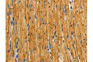 Phospho-FXYD1/PLM (Ser83) Antibody at 1/100 staining Rat heart tissue by IHC-P. (FXYD1 Antikörper  (pSer83))