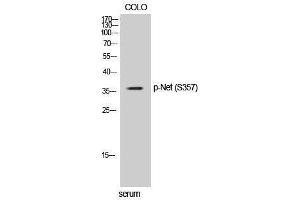 Western Blotting (WB) image for anti-ELK3, ETS-Domain Protein (SRF Accessory Protein 2) (ELK3) (pSer357) antibody (ABIN3182797) (ELK3 Antikörper  (pSer357))