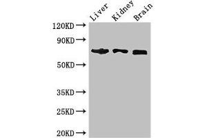 Western Blot Positive WB detected in: Mouse liver tissue, Mouse kidney tissue, Mouse brain tissue All lanes: TCF4 antibody at 2. (TCF4 Antikörper  (AA 419-525))