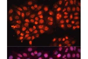 Immunofluorescence analysis of HeLa cells using ABCB8 Polyclonal Antibody at dilution of 1:100 (40x lens). (ABCB8 Antikörper)