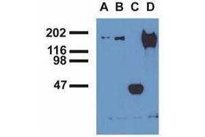Western Blotting (WB) image for anti-Epidermal Growth Factor Receptor (EGFR) (pTyr1016) antibody (ABIN400878) (EGFR Antikörper  (pTyr1016))