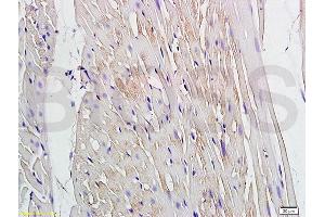 Immunohistochemistry (IHC) image for anti-Gap Junction Protein, alpha 4, 37kDa (GJA4) (AA 151-250) antibody (ABIN753343)