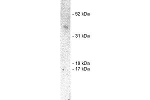 Western blot using  X1859P, rabbit polyclonal at 1  ug/ml on human brain lysate (20 ug/lane). (SIAH1 Antikörper)