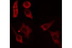 ABIN6279106 staining HepG2 cells by IF/ICC. (ACER1 Antikörper  (Internal Region))