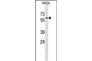 Western blot analysis in WiDr cell line lysates (35ug/lane). (SNX18 Antikörper  (C-Term))