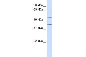 P2RY12 antibody used at 1 ug/ml to detect target protein. (P2RY12 Antikörper  (N-Term))
