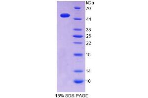 SDS-PAGE analysis of Mouse ITPA Protein. (ITPA Protein)