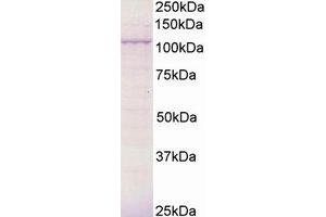 Image no. 1 for anti-Breast Cancer Anti-Estrogen Resistance 3 (BCAR3) (AA 813-825) antibody (ABIN292889) (BCAR3 Antikörper  (AA 813-825))