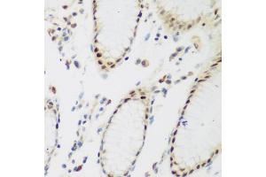 Immunohistochemistry of paraffin-embedded human stomach using PPAN antibody (ABIN5975126) at dilution of 1/200 (40x lens). (PPAN Antikörper)
