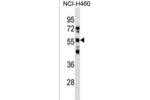 RBMY1D Antibody (C-term) (ABIN1537343 and ABIN2850417) western blot analysis in NCI- cell line lysates (35 μg/lane). (RBMY1D Antikörper  (C-Term))