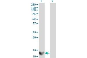 Western Blot analysis of LGALS1 expression in transfected 293T cell line by LGALS1 monoclonal antibody (M01), clone 1E8-1B2.