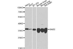 Western blot analysis of extracts of various cell lines, using GNB2 antibody. (GNB2 Antikörper)