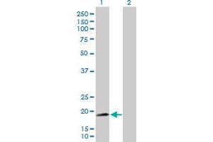 Western Blot analysis of NNT expression in transfected 293T cell line by NNT MaxPab polyclonal antibody.