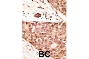 Immunohistochemistry (IHC) image for anti-Caudal Type Homeobox 2 (CDX2) antibody (ABIN3002517) (CDX2 Antikörper)