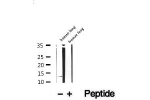 Western Blotting (WB) image for anti-DnaJ (Hsp40) Homolog, Subfamily C, Member 19 (DNAJC19) (Internal Region) antibody (ABIN6261335)