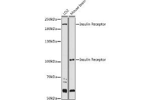 Western blot analysis of extracts of various cell lines, using Insulin Receptor antibody (ABIN3020883, ABIN3020884, ABIN3020885 and ABIN6213774) at 1:1000 dilution. (Insulin Receptor Antikörper  (AA 1130-1230))