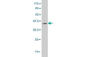Western Blot detection against Immunogen (36. (PRKG1 Antikörper  (AA 73-170))