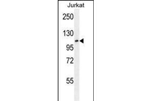 JHDM1a/FBXL11 Antibody (Center) (ABIN387896 and ABIN2844142) western blot analysis in Jurkat cell line lysates (35 μg/lane). (KDM2A Antikörper  (AA 500-527))